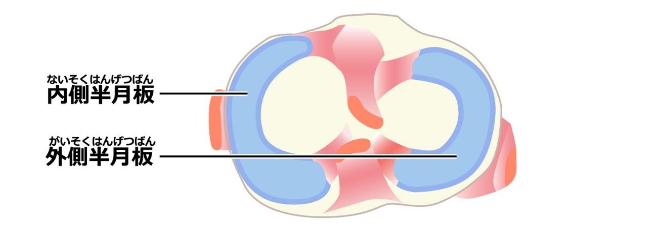 半月板損傷のイラスト