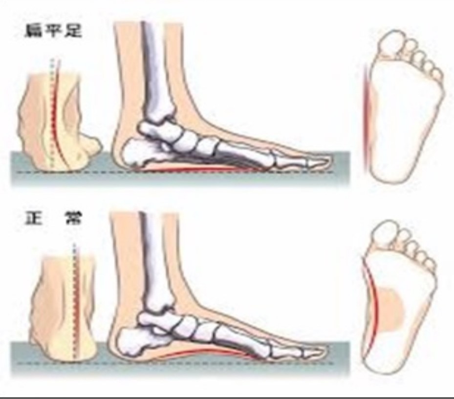 足のアーチについて書いたイラスト